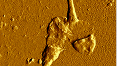 Detail pokozené spermie