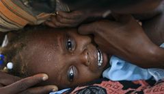 Haitské dít postiené cholerou