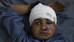 Chlapec zranný po útoku sebevraedného atentátníka