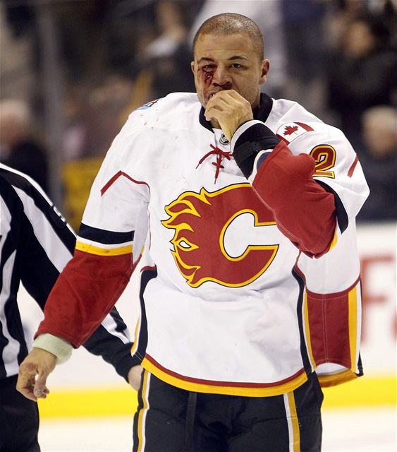 Zmlácený Jarome Iginla.