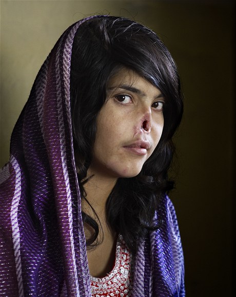 Vítězný snímek World Press Photo Afghánky s uříznutým nosem a ušima publikovaný na titulní straně Time