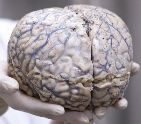 Lidsk mozek, pod naznutm obalem jsou vidt zvity ed kry mozkov.