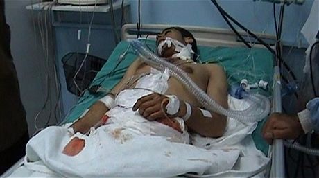 Pi pokusu o potlaení protivládních protest v Sýrii umírali lidé. Na snímku mu na jednotce intenzivnéí pée v nemocnici v Dará - centra protest.  