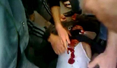 Zranný demonstrant pi protestech v syrském mst Homs