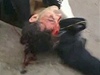 Zranný demonstrant v Damaku. 