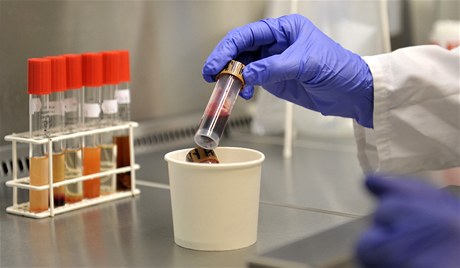 V laboratoi zkoumaj vzorek stolice lovka nakaenho bakteri EHEC