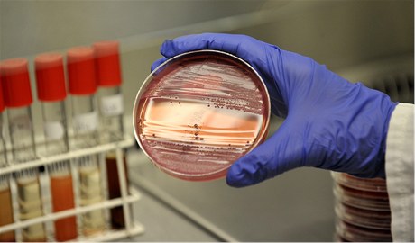Bakterie EHEC v petriho misce