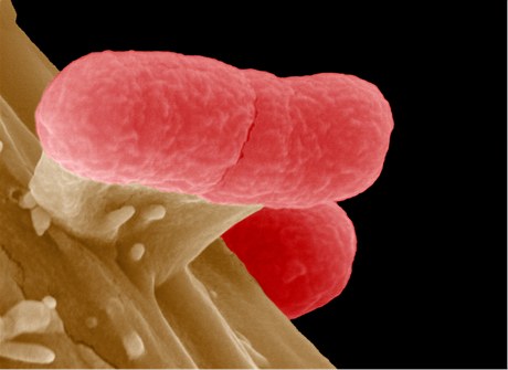 Bakterie EHEC 