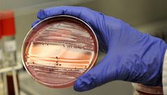 Nové léky proti bakteriím? Vědci hledají na mořském dně