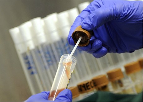 Pracovník německé laboratoře testuje přítomnost bakterie Escherichia coli.