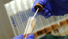 Pracovník německé laboratoře testuje přítomnost bakterie Escherichia coli.