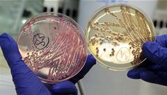 Experti: Bojujeme s nejjedovatějším typem bakterie