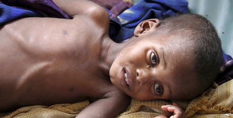 OSN vyhlásila v Somálsku hladomor 