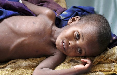 OSN vyhlásila v Somálsku hladomor 