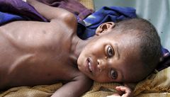 V Somlsku vypukl hladomor, zemely tisce lid