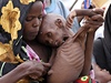 Hladomor v Somálsku. 