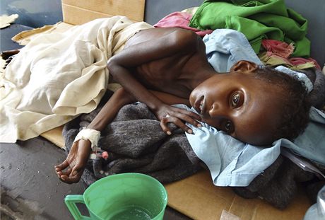 Hladovjící dít v Somálsku