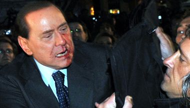 Berlusconi pot, co mu psychicky naruen mu zlomil nos a vyrazil dva zuby (13. prosinec 2009)