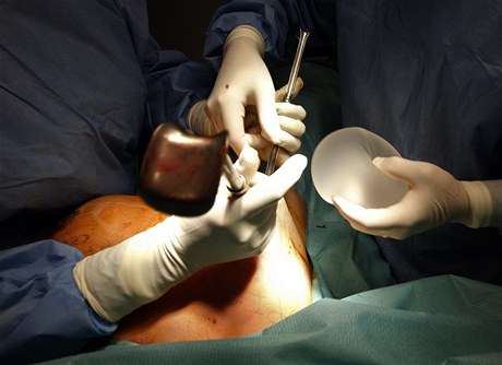 Lékař vyměňuje nebezpečné prsní implantáty.