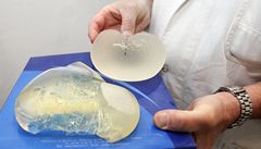 V Česku se objevil třetí problém u implantátů