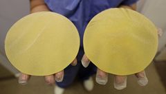Bulovka nabízí ženám s implantáty PIP sobotní operaci