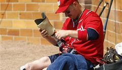 Hrá� McCardle si p�ed zápasem v New Yorku upravuje protézu. 