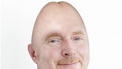 Grafik aTeo se pustil do Petra Skokana. �Ministr financí se ob�as dopustí p�esné diagnózy,� pí�e autor