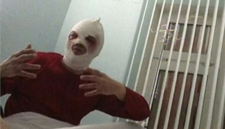 Sergej Filin v nemocnici den po útoku