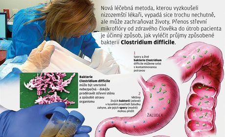 Léčba transplantovanou stolicí: přenos střevní mikroflóry vyléčí průjem |  Zdraví | Lidovky.cz