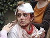 Žena zraněná výbuchem v Divadelní ulici.