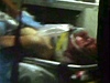 Dochar Carnajev v sanitce (snímek pevzatý z TV vysílání)