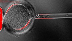 Průlom. Vědci získali buňky z klonovaných lidských embryí