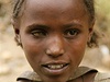 Mladá dívka z Etiopie s pokozeným okem
