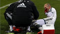 Ztráta pro Bayern. Robben se zranil a je mimo hru na šest týdnů