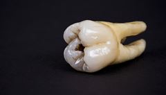 Zuby se podle vědců kazily i lovcům a sběračům plodů 