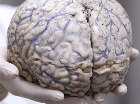 Lidský mozek (ilustraní fotografie)