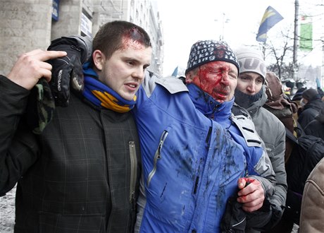 Jeden ze zranných demonstrant.