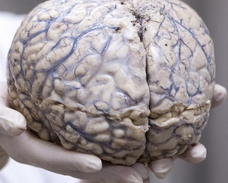 Lidský mozek (ilustraní fotografie)