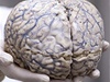 Lidský mozek (ilustrační fotografie)