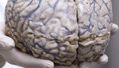 Amerian prodval mozky mrtvch z psychiatrie na eBayi