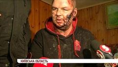 Ukrajinsk opozice: Bulatov nen vjimka, beze stopy zmizelo 36 lid