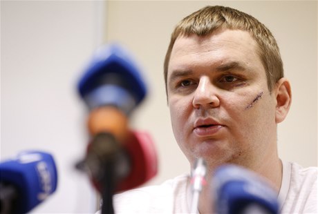 Ukrajinského opozičního aktivistu Dmytra Bulatova unesli a mučili neznámí útočníci.