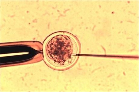 Živé vědy v Brně mají oživit český výzkum, na snímku biopsie embryonálních buněk.