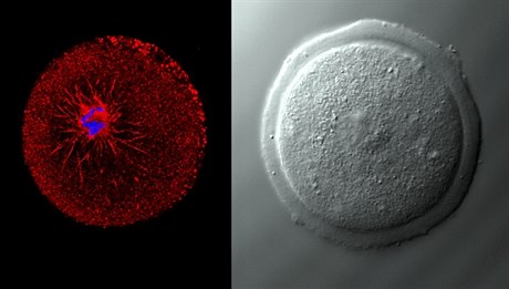 Snímek z konfokálního mikroskopu: mode je nabarvena DNA a erven protein Tubulin. Jde o oocyt ve stadiu meiotického zrání (ilustraní foto).