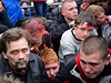 Prozápadní aktivisti, kteí byli zranni pi stetu s proruskými aktivisty.