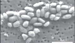 Objevené bakterie z jezera Mono, schopné žít z arzenu namísto fosforu, jsou dalším dokladem obrovské šíře pojmu život.