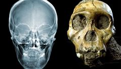 Lebka nedávno objeveného hominidního druhu Australopithecus sediba.