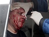 Zdravotník oetuje ukrajinského policistu, který byl zrann pi útoku proruských vzbouenc na policejní stanici v obci Horlivka.