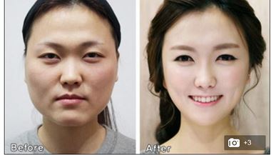 Po plastick operaci v Jin Koreji potebuj eny certifikt o totonosti