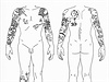 Pazyrycká mumie mla krom zdobného tetování i terapeutické teky na zádech.